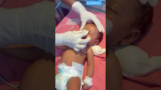 Newborn Nose Massage nicu newbornbaby medical [upl. by Arrek]