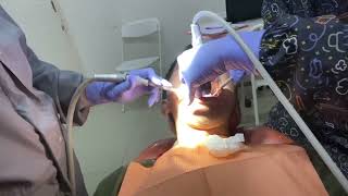 Nyobain scaling gigi paling murah di Orange Dental [upl. by Howey]