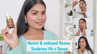 Most Honest review SESDERMA vitC serum A products that has changed my skin  liposomal Vitc Serum [upl. by Wit609]