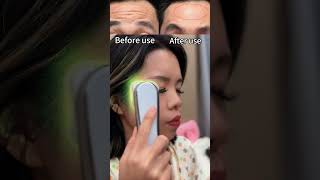 Reduce forehead wrinkles tips forehead wrinkles beautydevice beautyhacks beauty shorts [upl. by Atineb]