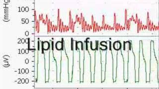 Bupivacaine Cardiotoxicity in an Anesthetized Rat [upl. by Nyhagen]