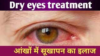 cmc eye drop used in hindi  tears top eye drop used in hindi  Tear Drops Eye Drops Uses in Hindi [upl. by Seen951]