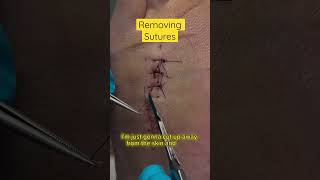 Satisfying Removal of Sutures asmr [upl. by Ettennyl]