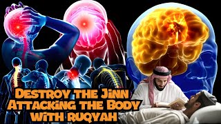 Ruqyah for the treatment of incurable diseases and witchcraft [upl. by Salisbarry]