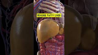 Top 10 Foods That Help Reverse Fatty Liver Disease [upl. by Sivatco]