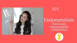 XIV ENDOMETRIÓZIS Hormonális fogamzásgátlók mellékhatásai [upl. by Ettegroeg]