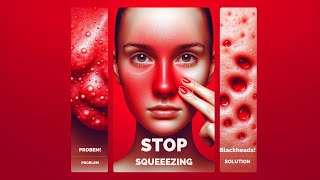 The Truth About Squeezing Blackheads [upl. by Hoashis]