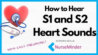 How to Hear S1 and S2 Heart Sounds [upl. by Godbeare]