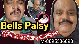 Bells Palsy Facial paralysis बेल्स पाल्सी ମୁହଁ ବଙ୍କା ହୋଇ ପାରାଲିଶିସ ଫିଜିଓ ଥେରାପିphysiotherapy [upl. by Enrak7]