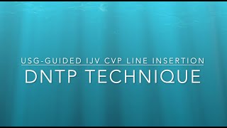 CVP line Insertion using DNTP technique Ultrasound guided central line insertion [upl. by Aicekat845]