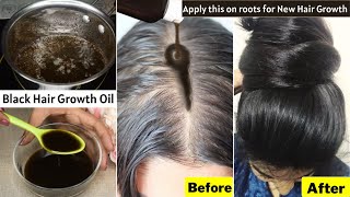 I Put👆🏼this Hair Growth Oil on Scalp To Grow Thick Dark Hair on Bald Areas Thinning Hair ampHair Loss [upl. by Ecinnej]