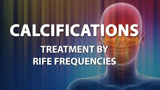 Calcifications  RIFE Frequencies Treatment  Energy amp Quantum Medicine with Bioresonance [upl. by Asirram]