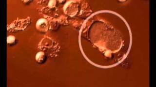 Time lapse video of the Chlamydia trachomatis developmental cycle [upl. by Carie]