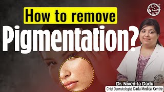 Types of Pigmentation on Face  How to Remove Pigmentation  Dermatology Treatment for Pigmentation [upl. by Goodrich]