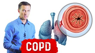 Chronic Obstructive Pulmonary Disease COPD [upl. by Slavic316]