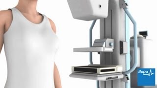 How a mammogram is carried out  Bupa Health [upl. by Eiblehs173]