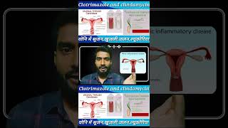 clotrimazole and clindamycin  cansoftcl  candidcl  vaginalinfection  shortvideo  viral [upl. by Mollee]