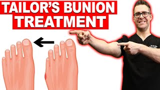 1 Tailors Bunion amp Bunionette Treatment Correctors Surgery [upl. by Llenyt]