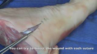 Suture  Basic Technique 2 [upl. by Shirl]