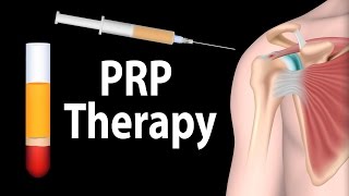 PRP Therapy Animation [upl. by Wier]