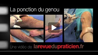 La ponction articulaire du genou comment bien effectuer le geste [upl. by Farlay599]