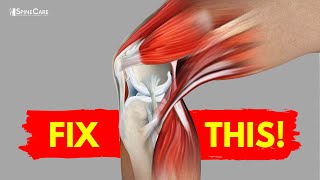 How to Fix Knee Pain for Good AT HOME [upl. by Mireille]