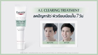 ผู้ชายเป็นสิวเยอะ จัดการด้วย Eucerin Pro ACNE SOLUTION AI CLEARING TREATMENT [upl. by Evin]