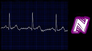 Sonido de monitor cardiaco  Heart monitor sound effect  Ekg sound  Sonido electrocardiograma [upl. by Sullecram910]