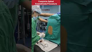 Complete spinal anaesthesia procedure by Dr Sarita Malik doctor mbbs anesthetic anesthesia neet [upl. by Press78]