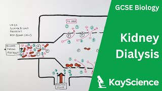 Kidney Dialysis  Biology GCSE  kaysciencecom [upl. by Donelson]