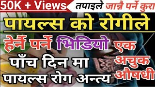 Piles Nepali Health Tips पायल्स के हो र कसरी बच्न सकिन्छ  पायल्स को घरेलु उपचार विधि Piles [upl. by Neelhtak112]