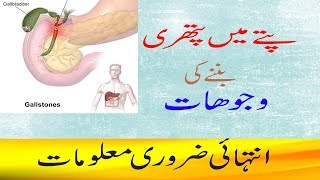 Gallstone Symptoms And Causes in UrduHindipitte ki pathri ki wajohat [upl. by Inesita]