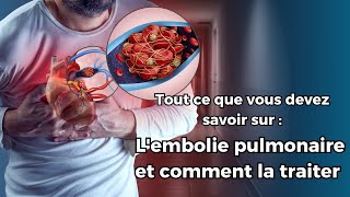 Lembolie pulmonaire  un risque fréquent mais souvent méconnu Voici comment se protéger [upl. by Arreyt574]