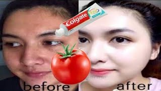 Mix tomato and toothpaste Skin whitening and anti wrinkle mask [upl. by Annahsed343]