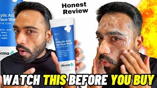 HONEST REVIEW The Derma Co Salicylic Acid Face Wash  ACNEPIMPLE Saviour The Derma Co Face Wash [upl. by Enedan762]