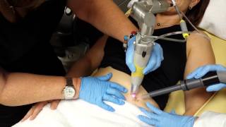 Laser Tattoo Removal Treatment  quotSunny Bubblesquot [upl. by Acker]