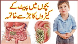 stomach worm pait main keero ka ilaj  chamoonay  pinworm  پیٹ میں کیڑے ختم کرنے کا آسان علاج [upl. by Iny854]