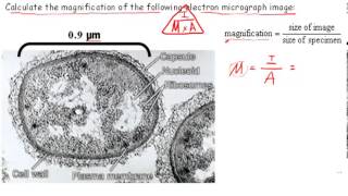 Calculating Magnification IB Biology [upl. by Arvind96]