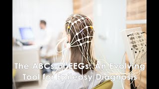 The ABCs of EEGs An Evolving Tool for Epilepsy Diagnosis [upl. by Amberly]