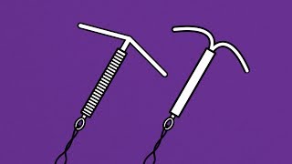 Brook Contraception  IUD and IUS Animation [upl. by Baalbeer]