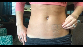 Fujimint Slimming Patch Review and test Is it scam Does it help for weight loss BEFORE AND AFTER [upl. by Lindgren]