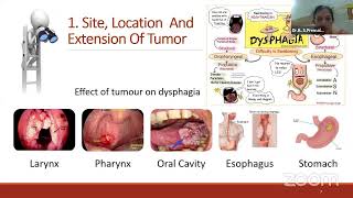 Dysphagia Awareness Month [upl. by Stutman]