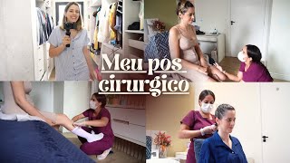 Como está sendo a minha recuperação pós cirurgia plástica [upl. by Myrtie]