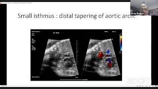 Lectures on fetal echo 1 [upl. by Soinski]