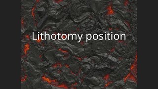 Lithotomy position [upl. by Devol642]