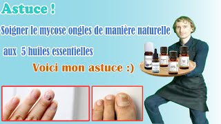 Lhuile essentielle ultime pour des soins complets et durables contre la mycose des ongles [upl. by Ijuy]