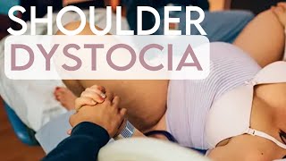 Shoulder Stuck on Pubic Bone during delivery Shoulder Dystocia [upl. by Halla]