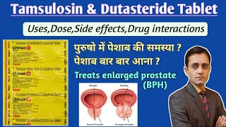 Tamsulosin hydrochloride and dutasteride tablet uses dose side effects in hindi  Urimax d tablet [upl. by Martell]