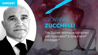 The Zuchelli technique combined with mucoderm® amp Straumann® Emdogain®  by Prof Dr G Zucchelli [upl. by Uticas]