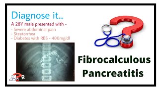 A case of Fibrocalculus pancreatitis [upl. by Zetroc]